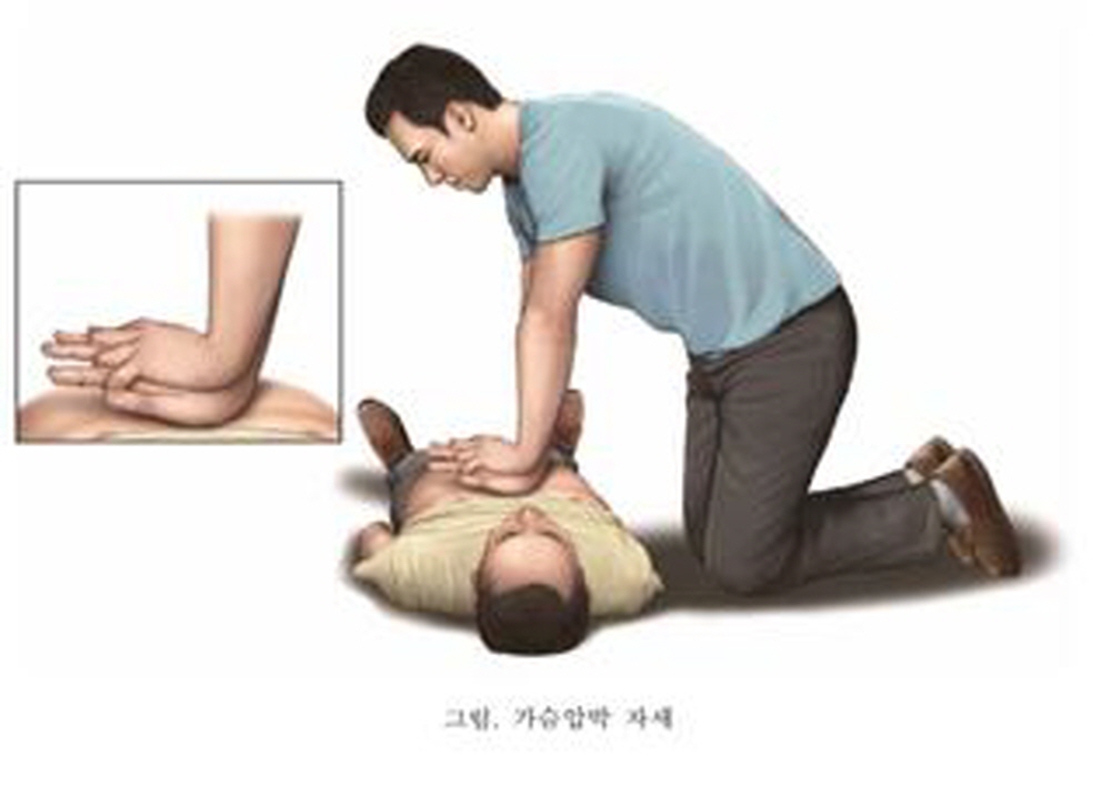 올바른 가슴압박 자세.